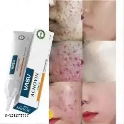 155 000 сум / шт. Крем для лица против прыщей и угрей Acnovin Cream Vasu