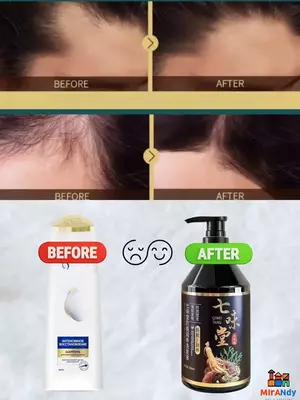 Лечебный китайский шампунь против выпадения волос Kasmetika.uz