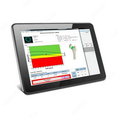 Цена по запросу Ультразвуковая денситометрическая станция EchoStation