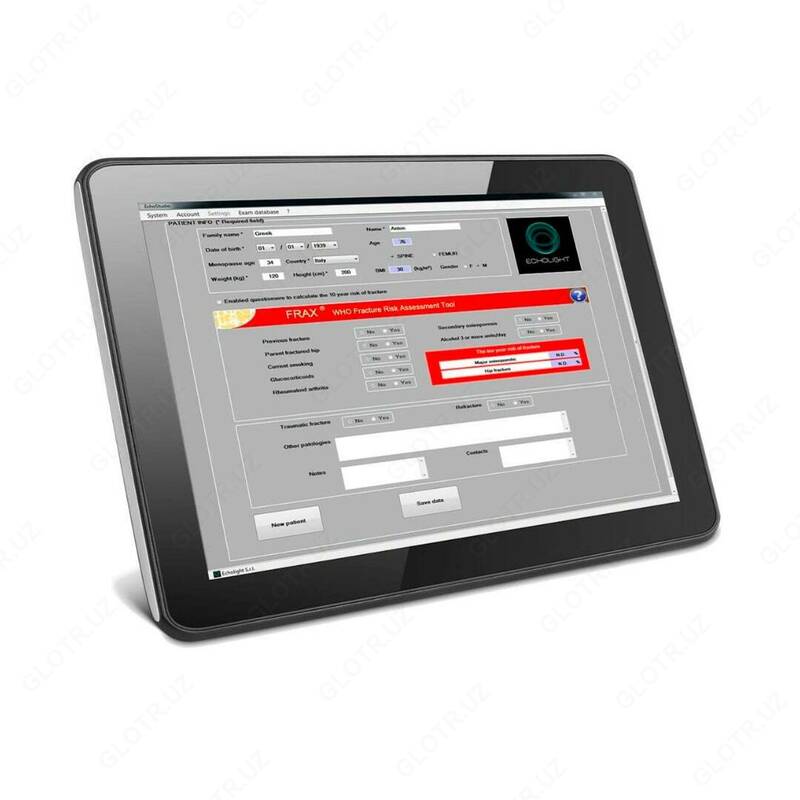 EchoStation ultratovushli densitometr Chakana savdo