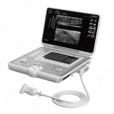 Аппарат УЗИ MYLAB SIGMA