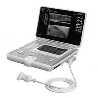Ультразвуковой аппарат MyLab SIGMA - по запросу