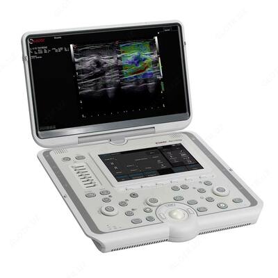 Ультразвуковой аппарат MyLab OMEGA