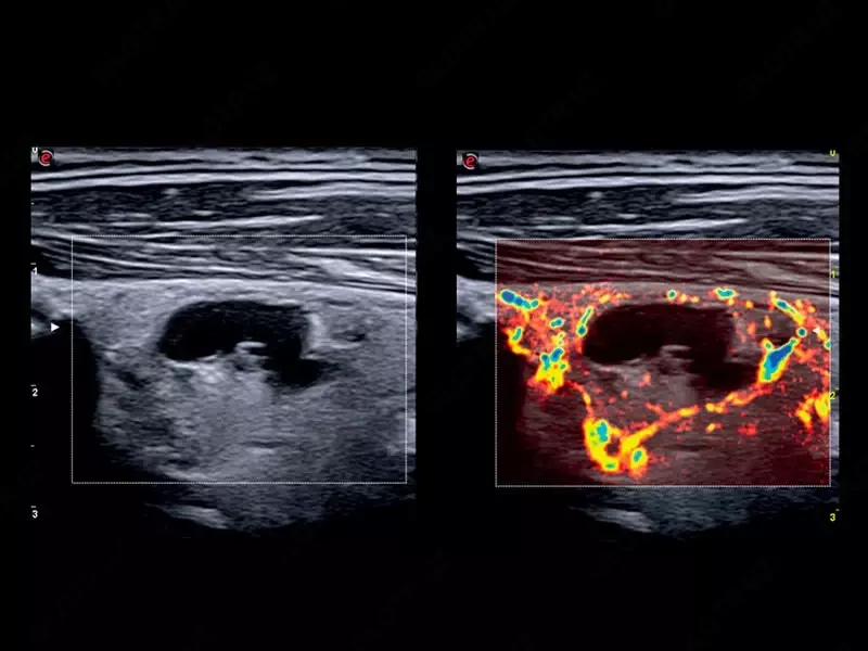Универсальный ультразвуковой (УЗИ) сканер Esaote MyLab X75 - от 719 405 400 сум