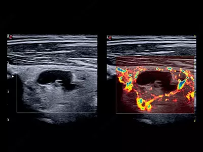 Универсальный ультразвуковой (УЗИ) сканер Esaote MyLab X75 - от 714 742 800 сум / шт.
