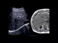 от 719 405 400 сум Универсальный ультразвуковой (УЗИ) сканер Esaote MyLab X75