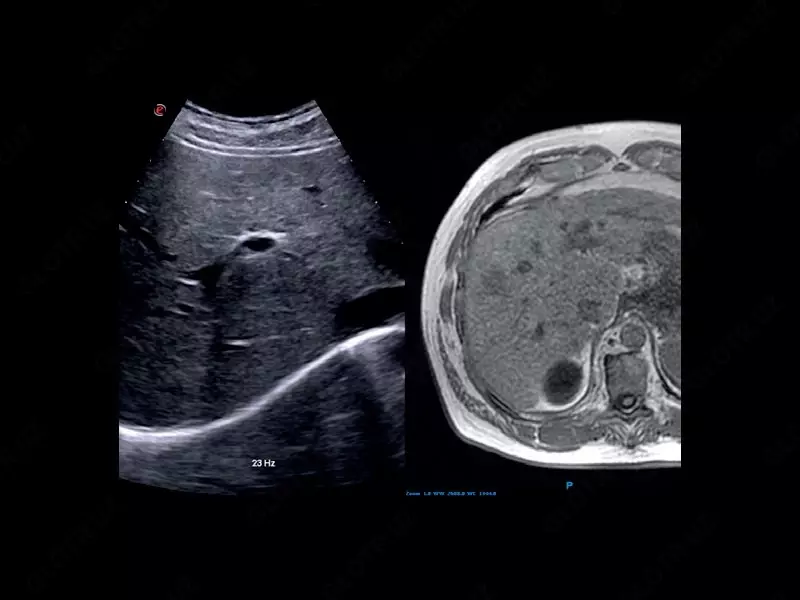 от 719 405 400 сум Универсальный ультразвуковой (УЗИ) сканер Esaote MyLab X75