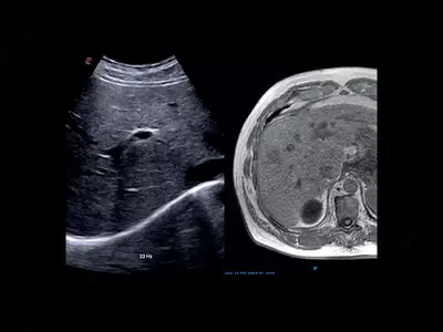 от 714 742 800 сум / шт. Универсальный ультразвуковой (УЗИ) сканер Esaote MyLab X75