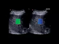 Универсальный ультразвуковой (УЗИ) сканер Esaote MyLab X75 OOO «Sun Gate International»