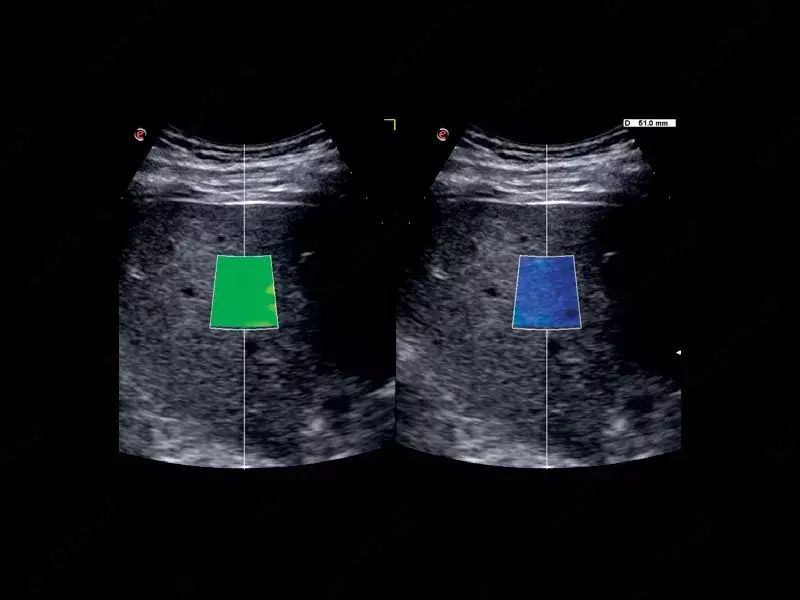 Универсальный ультразвуковой (УЗИ) сканер Esaote MyLab X75 OOO «Sun Gate International»