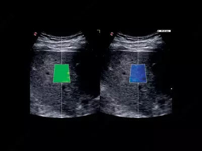 Универсальный ультразвуковой (УЗИ) сканер Esaote MyLab X75 OOO «Sun Gate International»