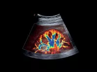 Универсальный ультразвуковой (УЗИ) сканер Esaote MyLab X75 - OOO «Sun Gate International»