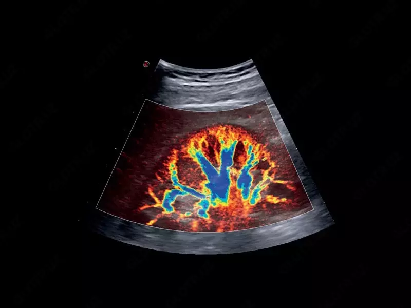 Универсальный ультразвуковой (УЗИ) сканер Esaote MyLab X75 - OOO «Sun Gate International»