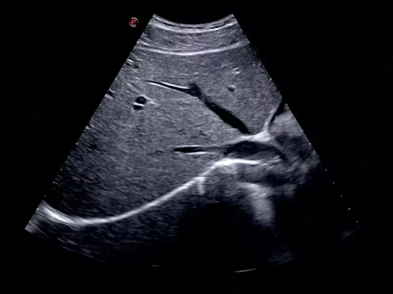 OOO «Sun Gate International» - Универсальный ультразвуковой (УЗИ) сканер Esaote MyLab X75