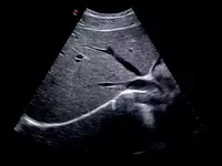 OOO «Sun Gate International» - Универсальный ультразвуковой (УЗИ) сканер Esaote MyLab X75