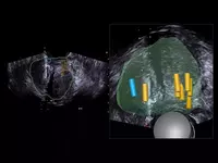 Ультразвуковой томограф (УЗИ) нового поколения ESAOTE MyLab X90 - от 1 020 270 300 сум