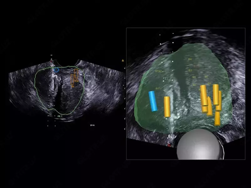 Ультразвуковой томограф (УЗИ) нового поколения ESAOTE MyLab X90 - от 1 020 270 300 сум