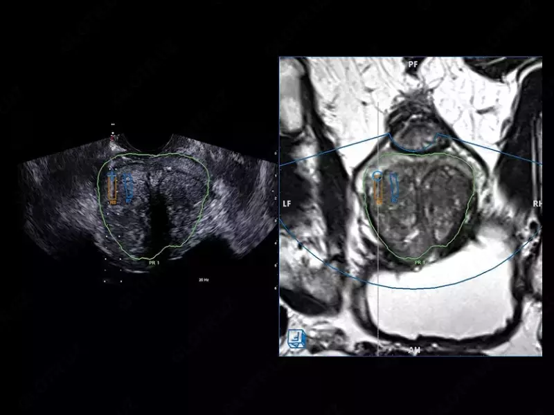 от 1 020 270 300 сум Ультразвуковой томограф (УЗИ) нового поколения ESAOTE MyLab X90