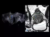 от 1 020 270 300 сум Ультразвуковой томограф (УЗИ) нового поколения ESAOTE MyLab X90