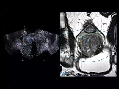 от 1 016 874 550 сум / шт. Ультразвуковой томограф (УЗИ) нового поколения ESAOTE MyLab X90