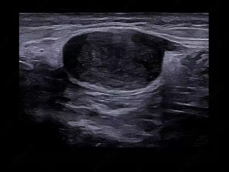 Ультразвуковой томограф (УЗИ) нового поколения ESAOTE MyLab X90 Только в розницу