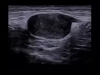 Ультразвуковой томограф (УЗИ) нового поколения ESAOTE MyLab X90 Только в розницу