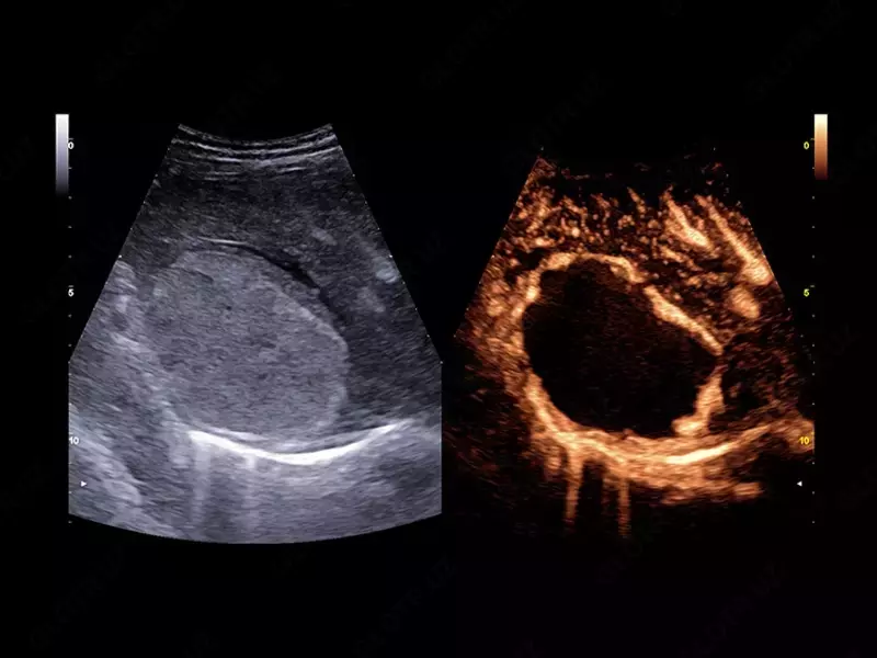 Ультразвуковой томограф (УЗИ) нового поколения ESAOTE MyLab X90 OOO «Sun Gate International»