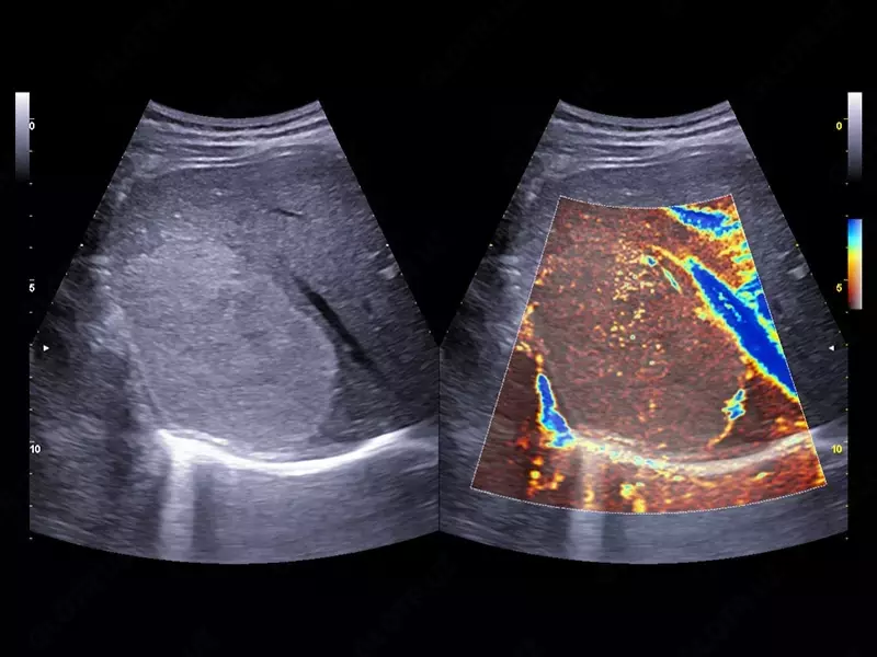 Ультразвуковой томограф (УЗИ) нового поколения ESAOTE MyLab X90 - OOO «Sun Gate International»