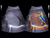 Ультразвуковой томограф (УЗИ) нового поколения ESAOTE MyLab X90 - OOO «Sun Gate International»