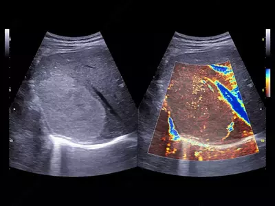 Ультразвуковой томограф (УЗИ) нового поколения ESAOTE MyLab X90 - OOO «Sun Gate International»