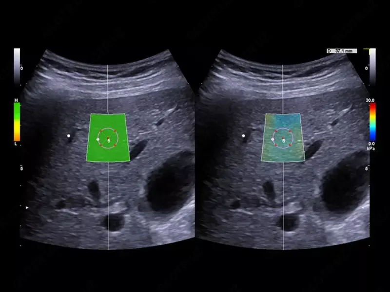 OOO «Sun Gate International» - Ультразвуковой томограф (УЗИ) нового поколения ESAOTE MyLab X90