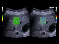 OOO «Sun Gate International» - Ультразвуковой томограф (УЗИ) нового поколения ESAOTE MyLab X90