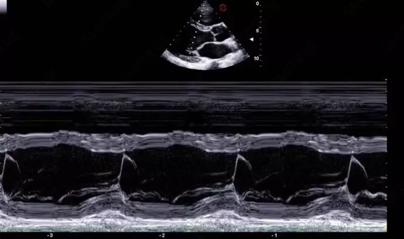 Ультразвуковой сканер экспертного класса Esaote A50 Только в розницу