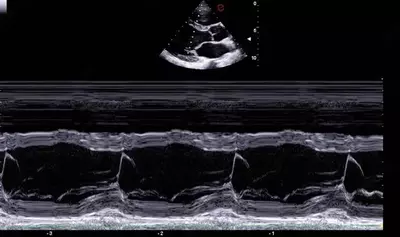 Ультразвуковой сканер экспертного класса Esaote A50 Только в розницу
