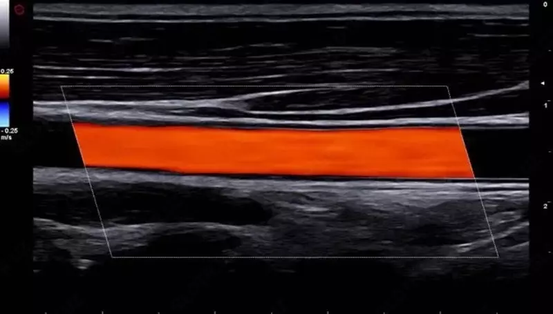 Ультразвуковой сканер экспертного класса Esaote A50 OOO «Sun Gate International»