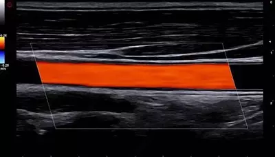 Ультразвуковой сканер экспертного класса Esaote A50 OOO «Sun Gate International»