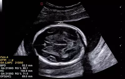 Ультразвуковой сканер экспертного класса Esaote A50 - OOO «Sun Gate International»