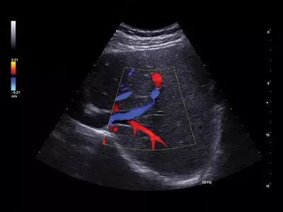 Esaote A50 ekspert toyfali ultratovushli skaneri