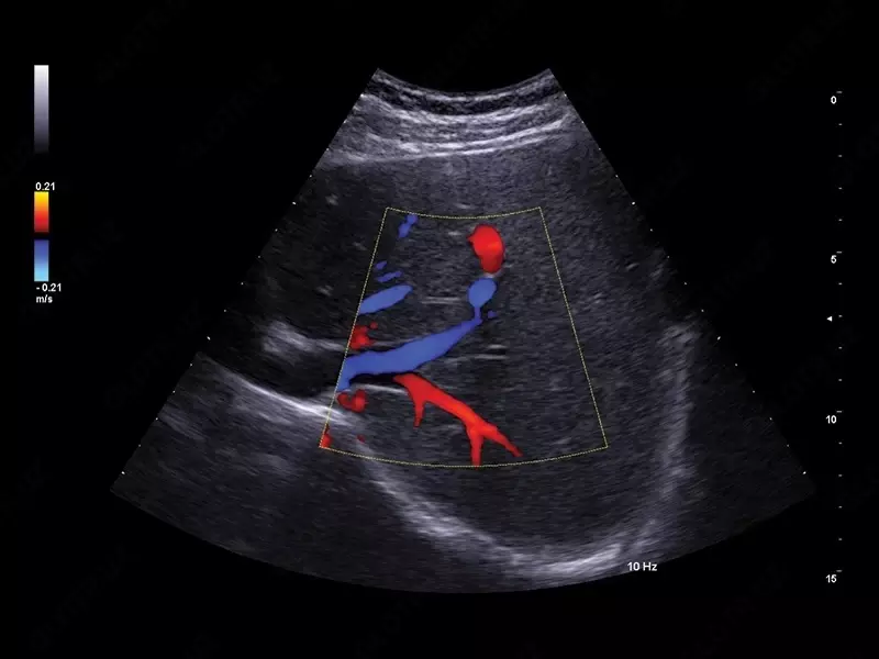 Ультразвуковой сканер экспертного класса Esaote A50 - Диагностическое оборудование