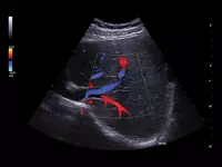 Ультразвуковой сканер экспертного класса Esaote A50 - Диагностическое оборудование