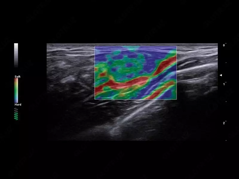 Ультразвуковой сканер экспертного класса Esaote A50 Диагностическое оборудование