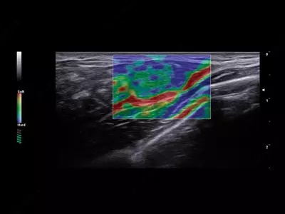 Esaote A50 ekspert toyfali ultratovushli skaneri