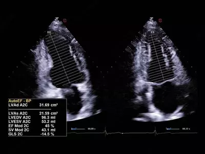 Ультразвуковой сканер премиум класса Esaote MyLab A70 Только в розницу