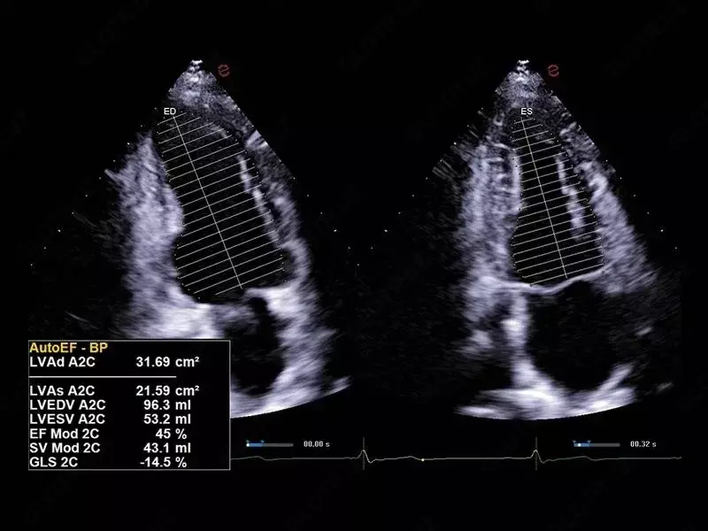 Ультразвуковой сканер премиум класса Esaote MyLab A70 Только в розницу