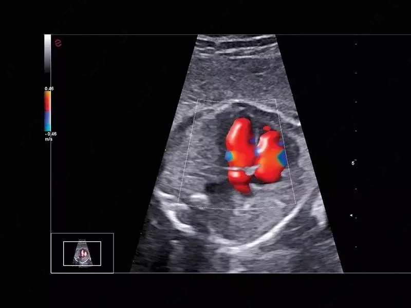 Ультразвуковой сканер премиум класса Esaote MyLab A70 OOO «Sun Gate International»