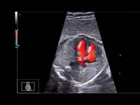 Ультразвуковой сканер премиум класса Esaote MyLab A70 OOO «Sun Gate International»