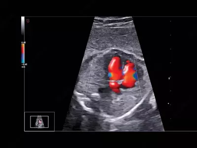 Ультразвуковой сканер премиум класса Esaote MyLab A70 OOO «Sun Gate International»