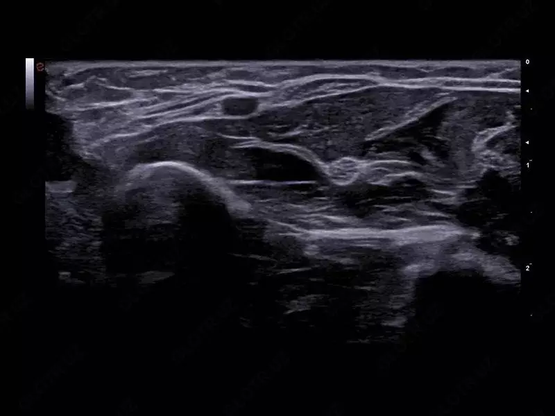 Ультразвуковой сканер премиум класса Esaote MyLab A70 - OOO «Sun Gate International»