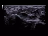 Ультразвуковой сканер премиум класса Esaote MyLab A70 - OOO «Sun Gate International»