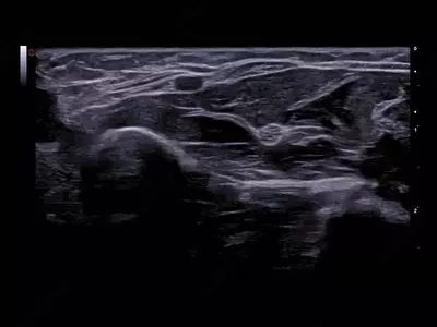 Ультразвуковой сканер премиум класса Esaote MyLab A70 - OOO «Sun Gate International»